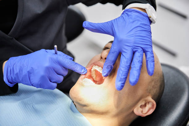 Best Emergency Dentist for Lost Fillings or Crowns in Hewlett, NY